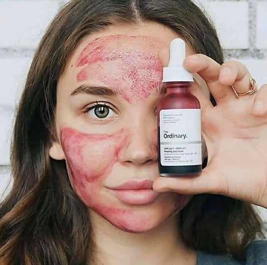 Peeling Solution AHA 30% + BHA 2% – Exfoliación Química Intensiva